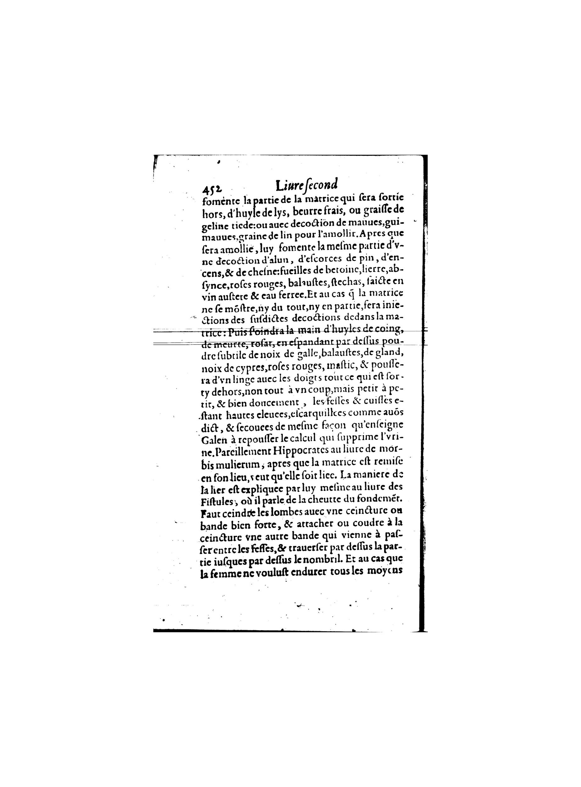 1587 - Jacques du Puis - Trésor des remèdes secrets pour les maladies des femmes - BnF