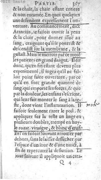 1612 - Thomas Portau - Trésor de chirurgie - BIU Santé