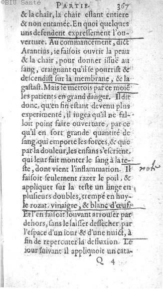 1612 - Thomas Portau - Trésor de chirurgie - BIU Santé_Page_380.jpg