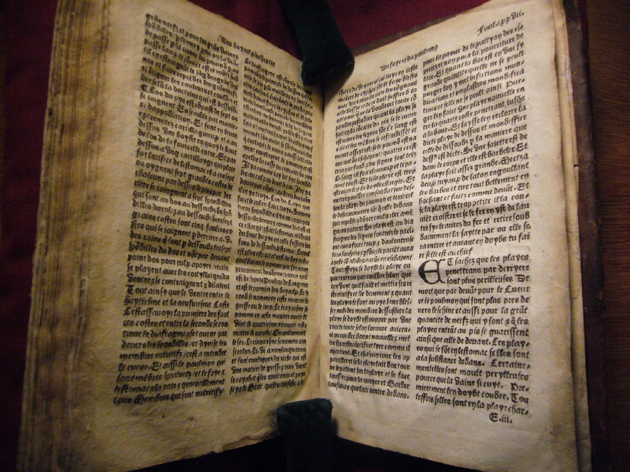 1512c. - Veuve Jehan Trepperel et Jehan Jehannot - Trésor des pauvres -  ex. 2 - BnF Tolbiac
