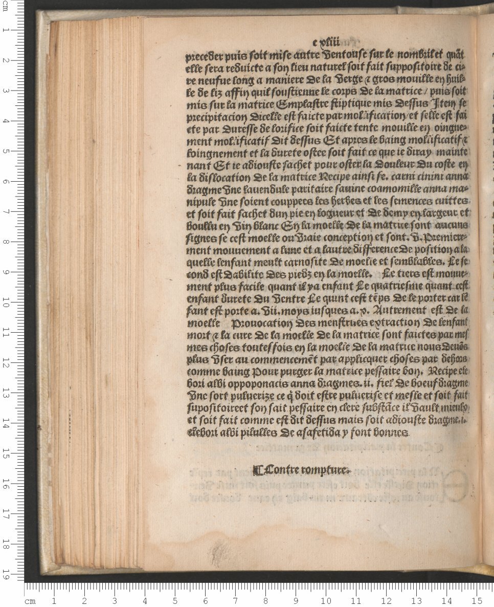 1503 - Antoine Vérard - Trésor des pauvres - Bibliothèque Sainte-Geneviève