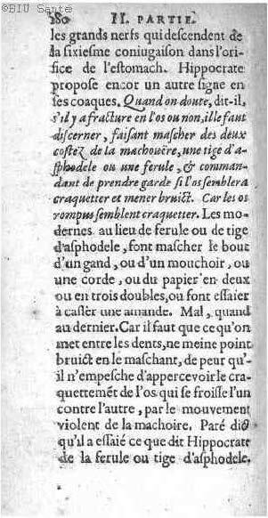 1612 - Thomas Portau - Trésor de chirurgie - BIU Santé_Page_193.jpg