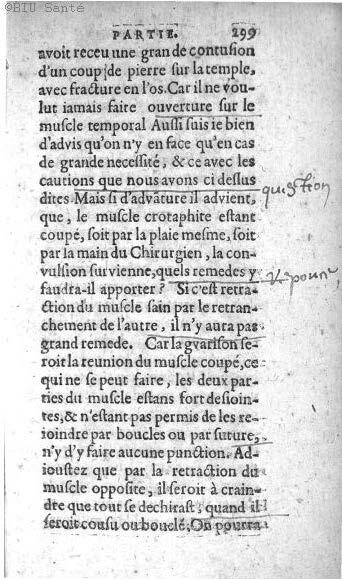 1612 - Thomas Portau - Trésor de chirurgie - BIU Santé