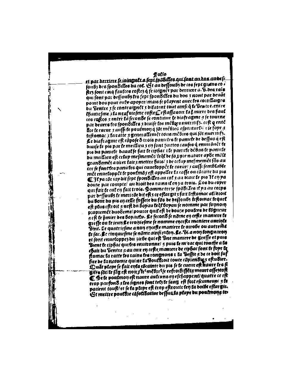 1512 - Michel Le Noir - Trésor des pauvres - BnF