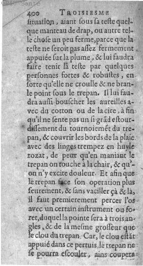 1612 - Thomas Portau - Trésor de chirurgie - BIU Santé