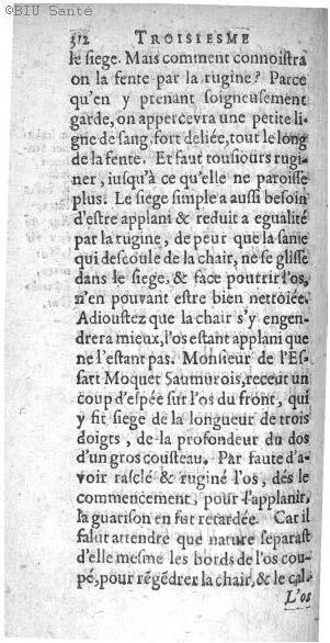 1612 - Thomas Portau - Trésor de chirurgie - BIU Santé
