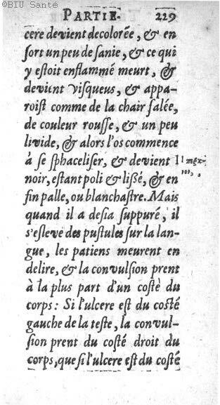 1612 - Thomas Portau - Trésor de chirurgie - BIU Santé