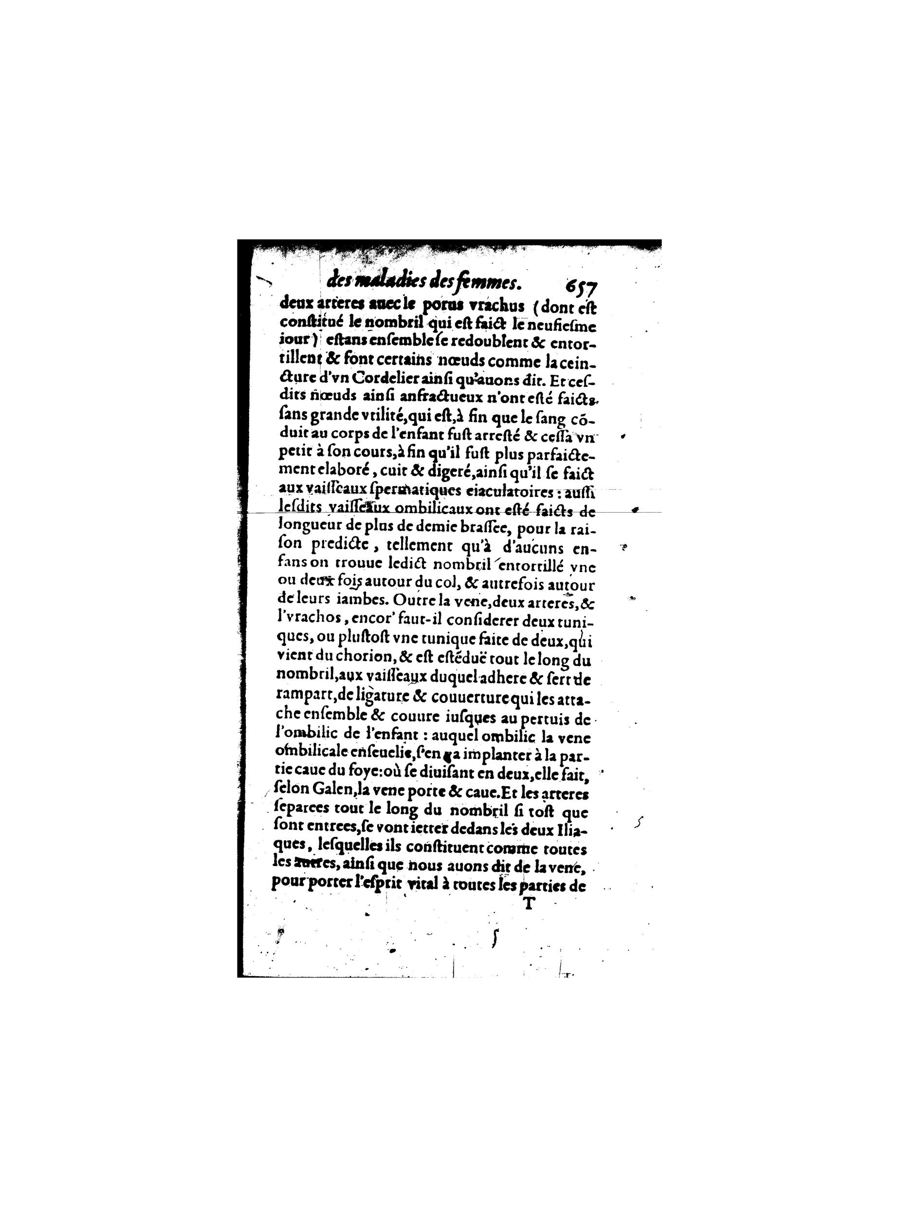 1587 - Jacques du Puis - Trésor des remèdes secrets pour les maladies des femmes - BnF 1587 - Jacques du Puis - Trésor des remèdes secrets pour les maladies des femmes - BnF