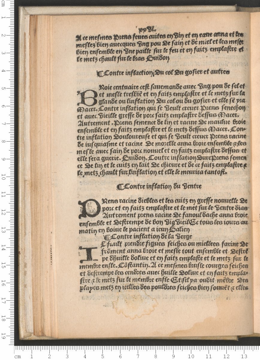 1503 - Antoine Vérard - Trésor des pauvres - Bibliothèque Sainte-Geneviève