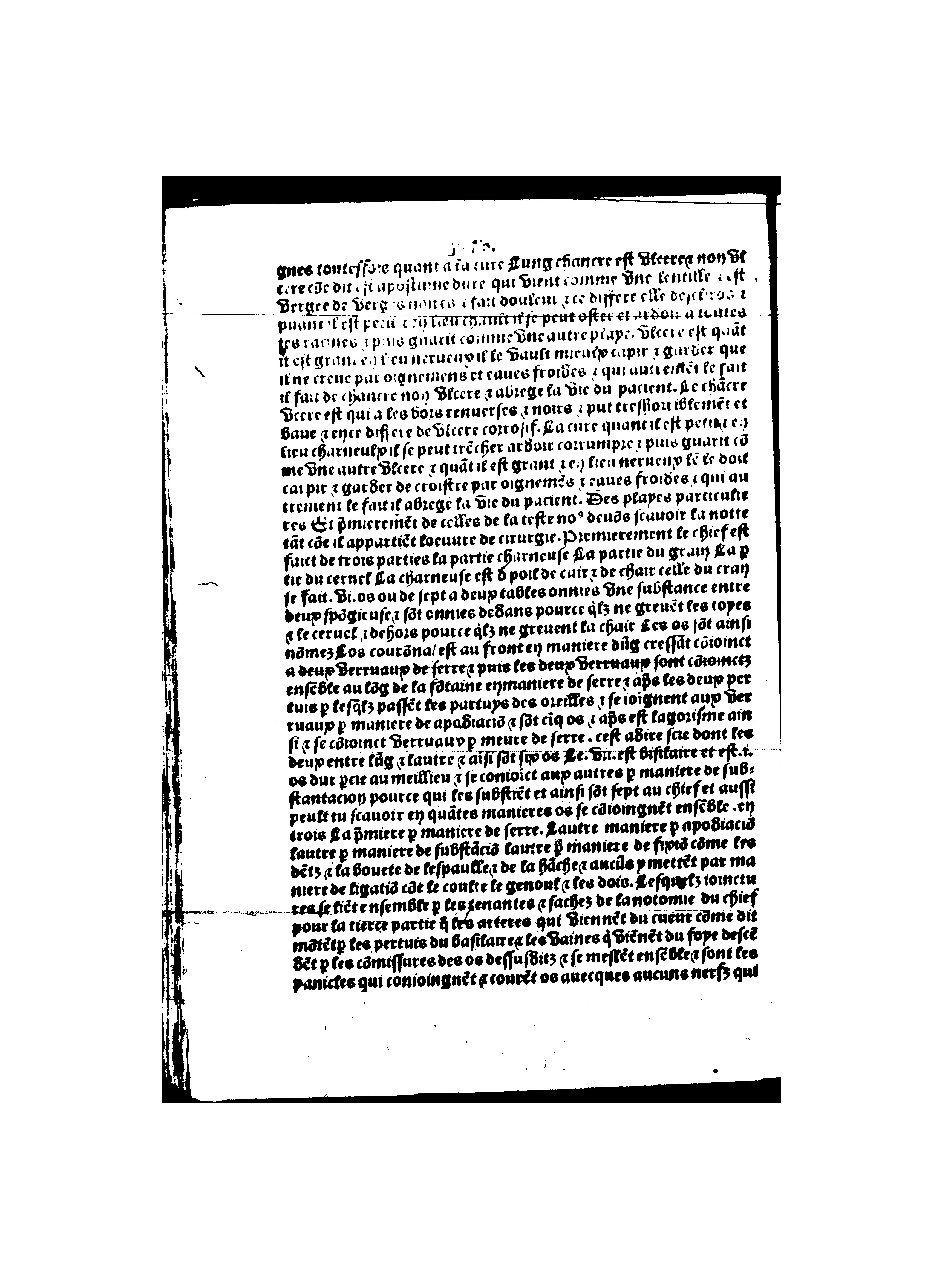 1512 - Michel Le Noir - Trésor des pauvres - BnF