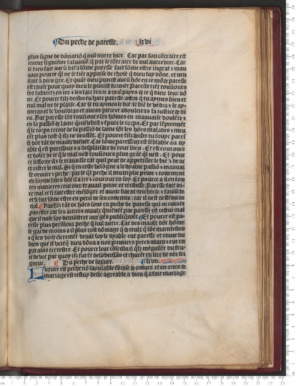 1482 - [Jean Du Pré] - Trésor des humains - Bibliothèque Sainte-Geneviève