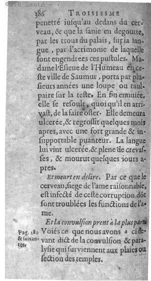 1612 - Thomas Portau - Trésor de chirurgie - BIU Santé_Page_399.jpg