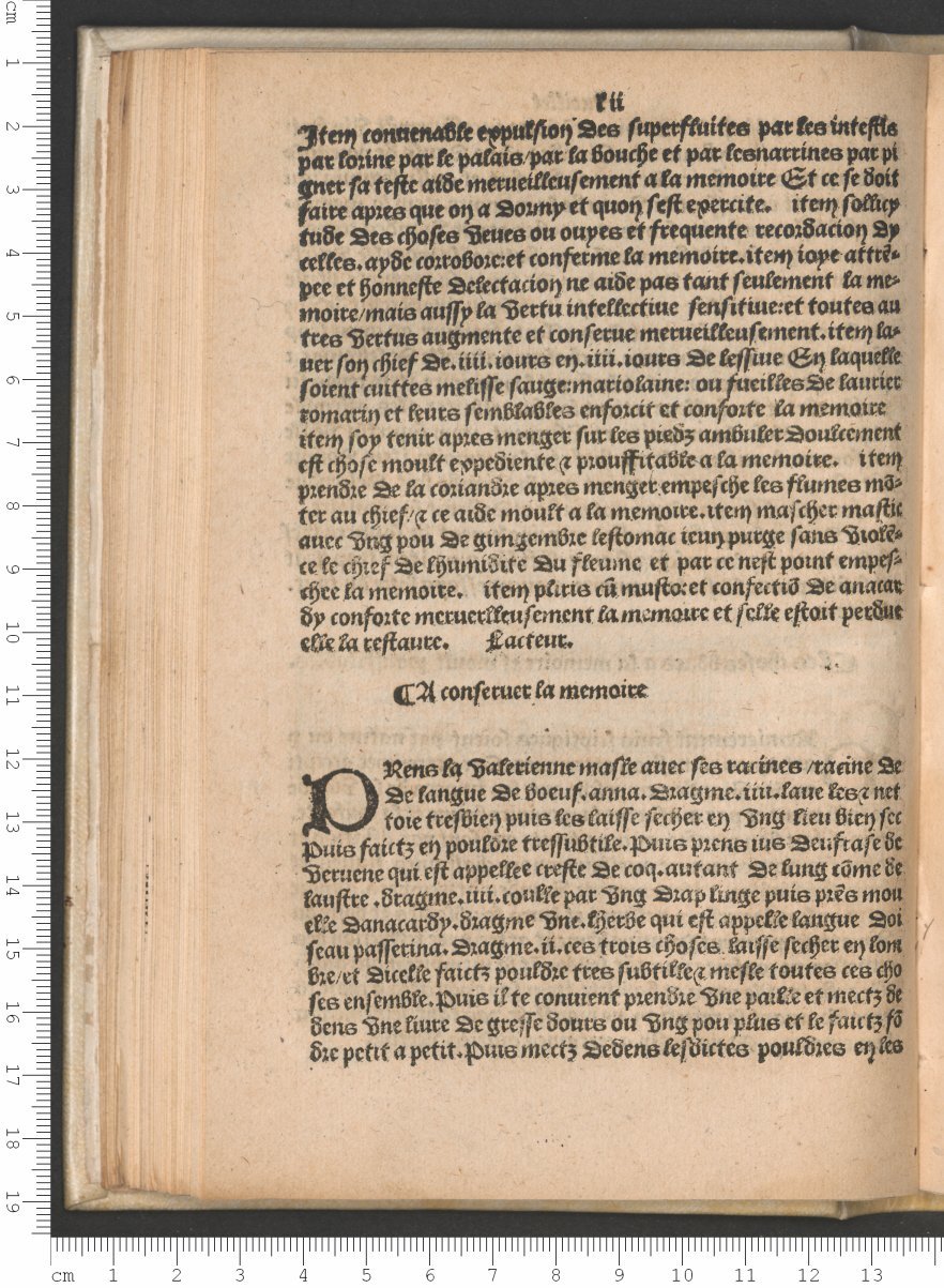 1503 - Antoine Vérard - Trésor des pauvres - Bibliothèque Sainte-Geneviève