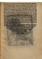 1544 - s.n. - Trésor du remède préservatif et guérison de la peste - British Library