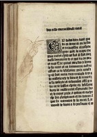 1477c. - Guillaume Le Roy - Trésor de sapience - Médiathèques Carcassonne Agglo